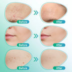 CareBreeze® 3-in-1 Microneedle Care Patch
