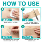 CareBreeze® 3-in-1 Microneedle Care Patch