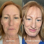 Dermly GHK-Cu Overnight Wrapping Mask