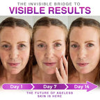 CareBreeze® 3-in-1 Microneedle Anti-Aging Patch