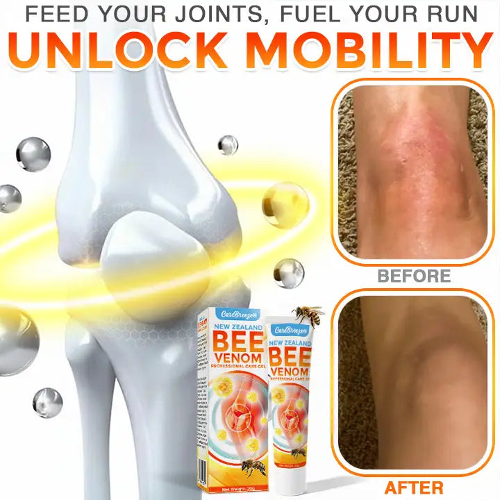 CareBreeze® New Zealand Bee Venom Professional Care Gel
