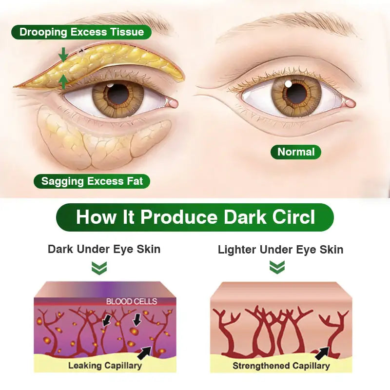 CareBreeze® Pepti-Tox & Caffeine Shot Wrinkle-Lift Depuffing Microdart Patch